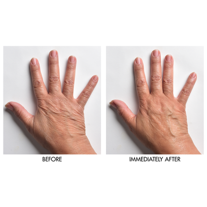 Instant Hand Perfector