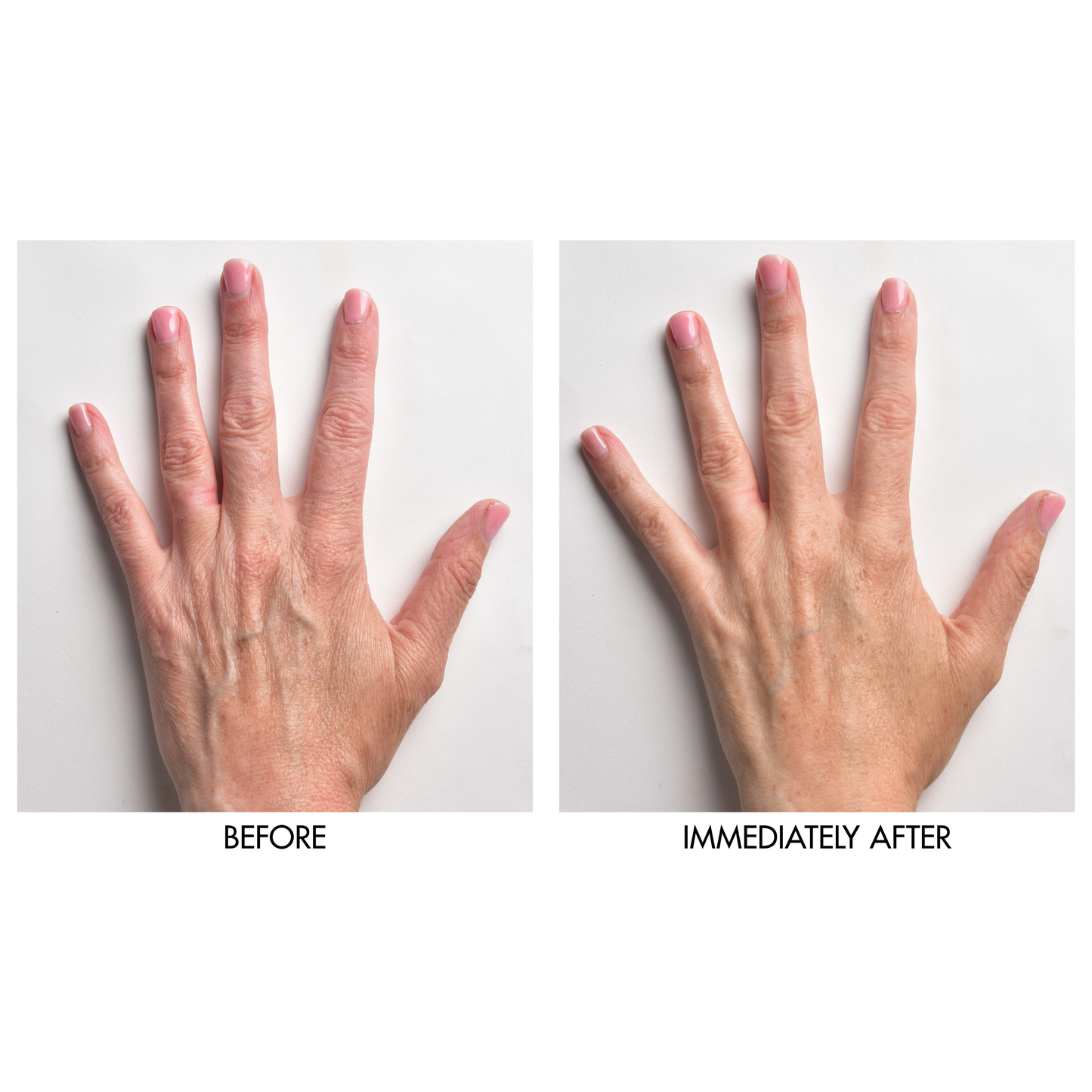 Instant Hand Perfector