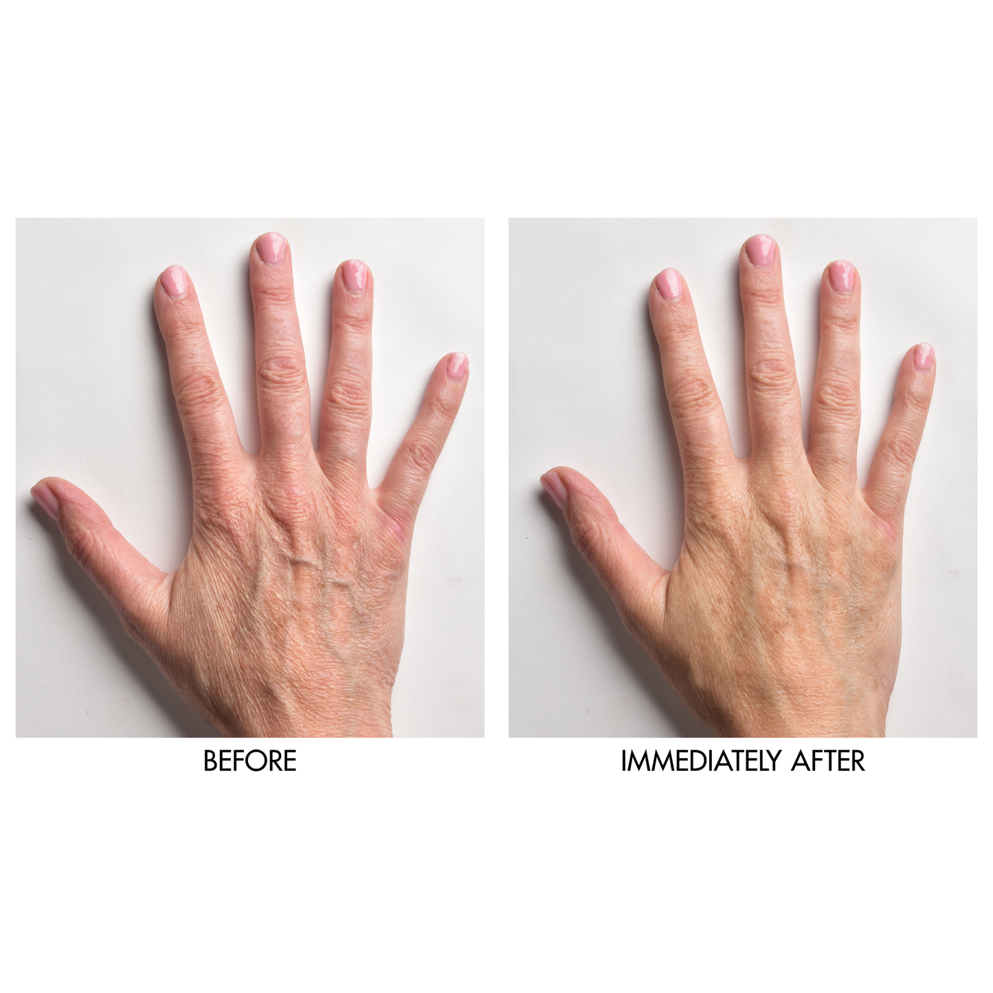 Instant Hand Perfector